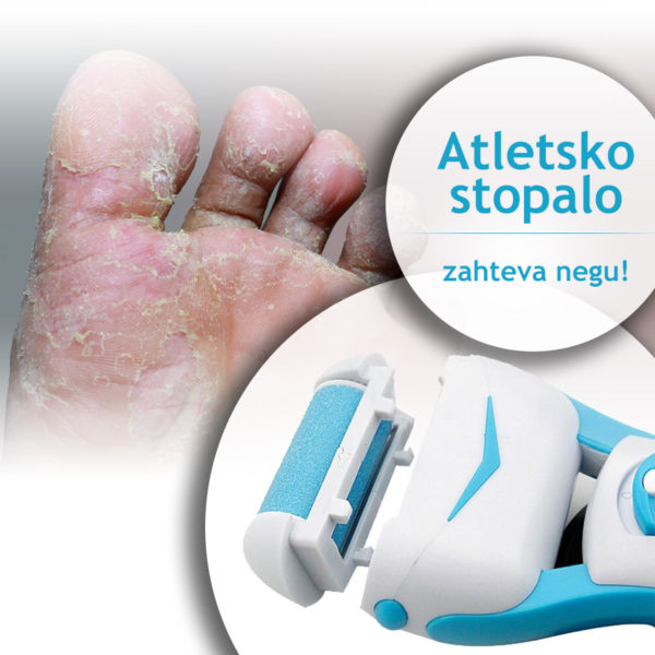 Električna aparat-turpija za pete Personal Pedi sa roler glavom - Image 2