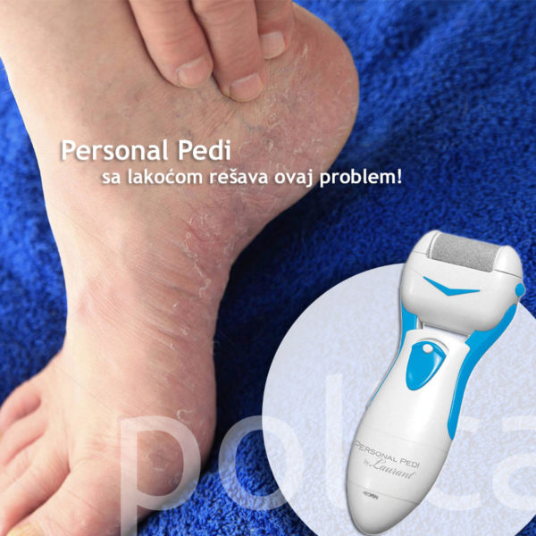 Električna aparat-turpija za pete Personal Pedi sa roler glavom - Image 6